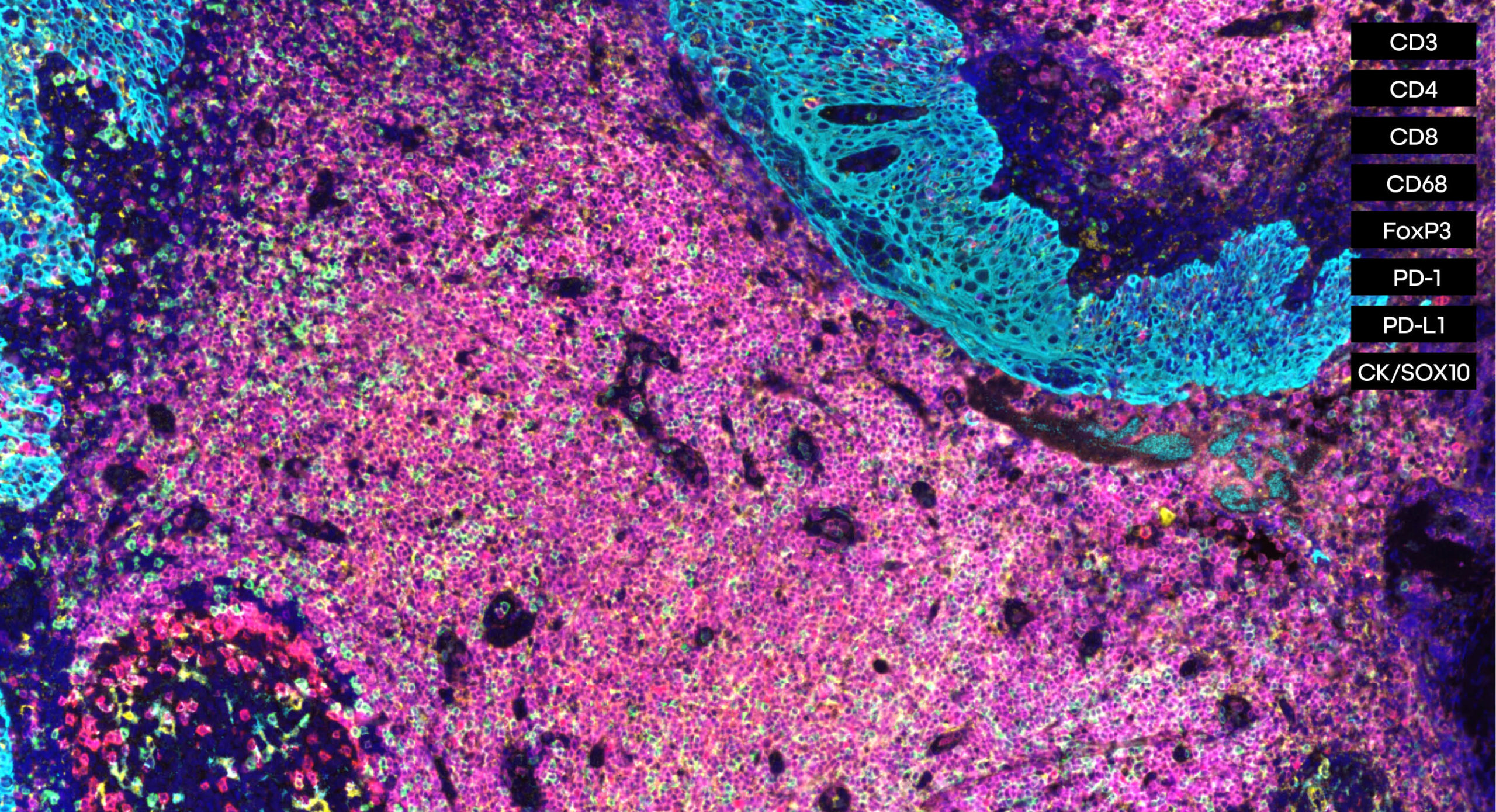 Immuno8 FixVUE panel