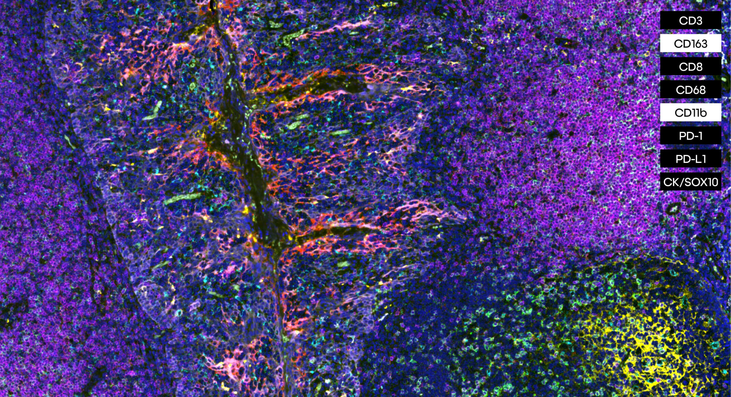 Macrophage panel