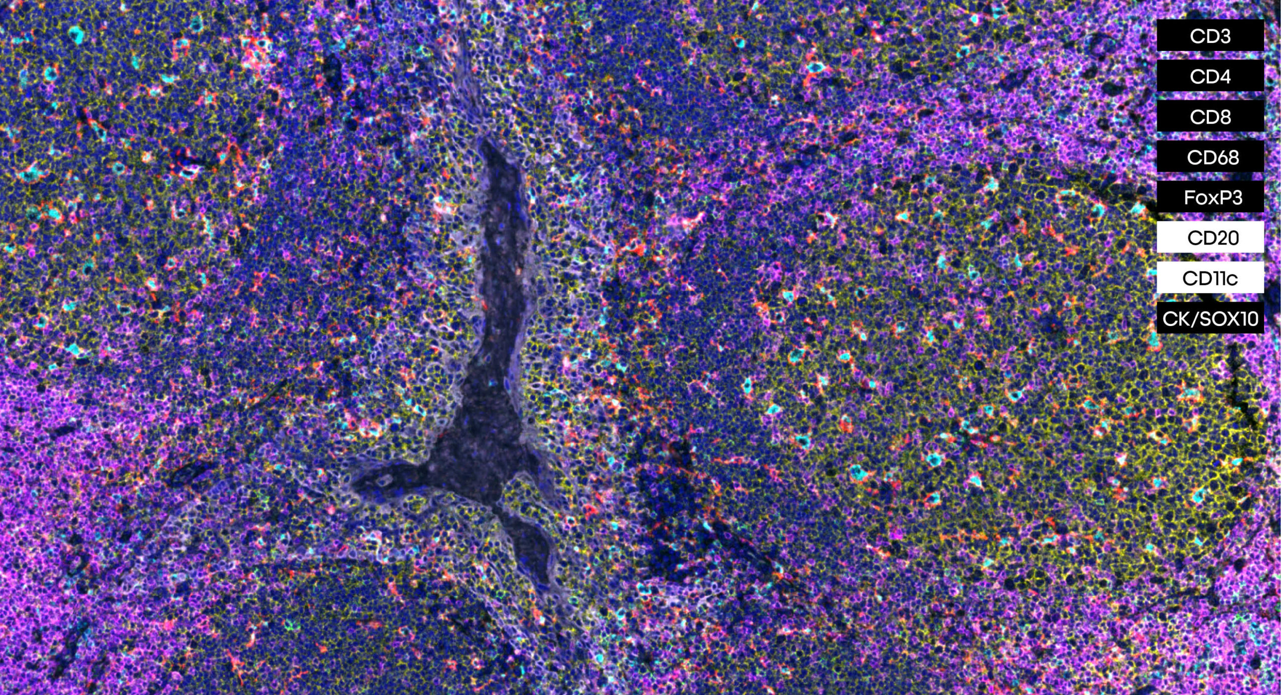 Tertiary Lymphoid Structure panel