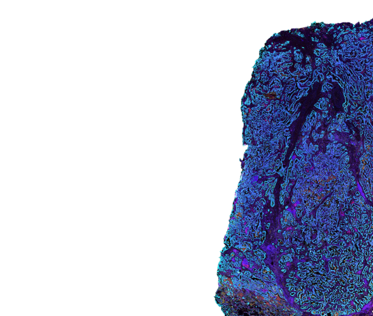 Ultivue Announces Co-Marketing Agreement with Sirona DX for Multiplexed Tissue Biomarker Solutions for Precision Medicine