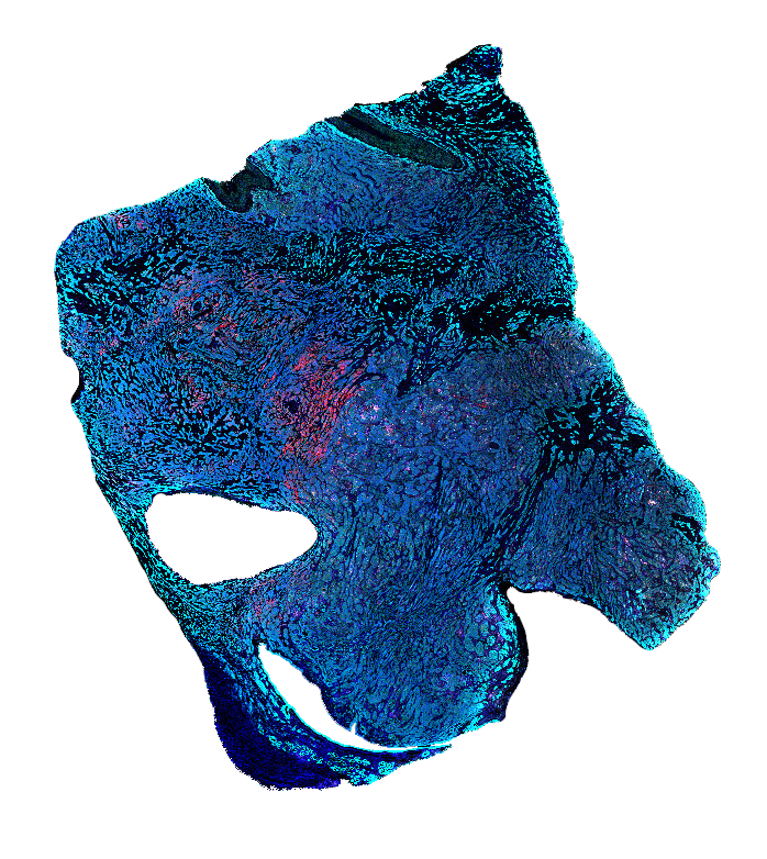 Fluorescent