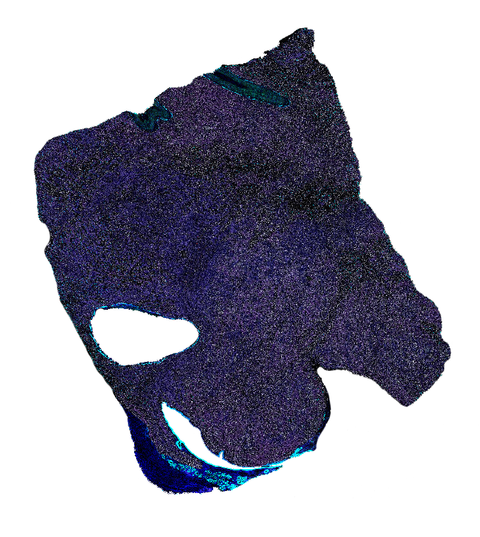 Segment