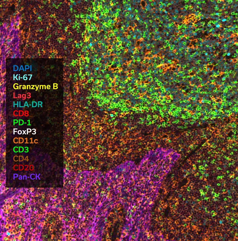 Expand your insights into the TME (tumor microenvironment):