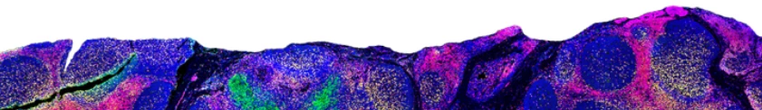 Unprecedented spatial insights
