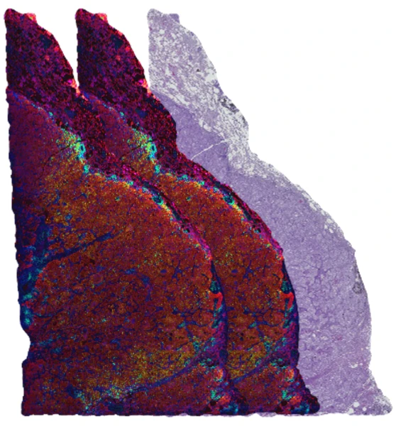 Three Tissue Slides]